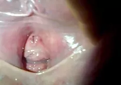 Slender brunette gets fucked by cancer